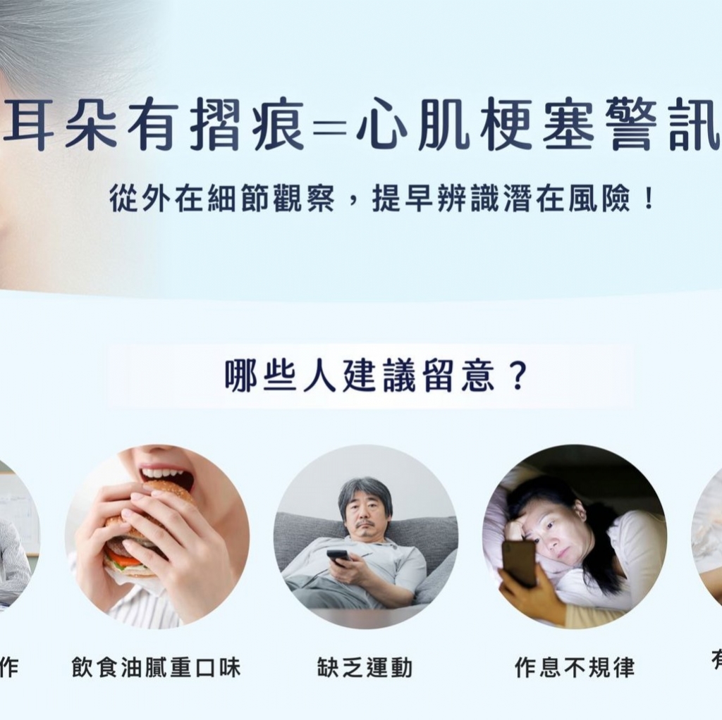😨在照鏡子時，突然發現耳垂有摺痕？